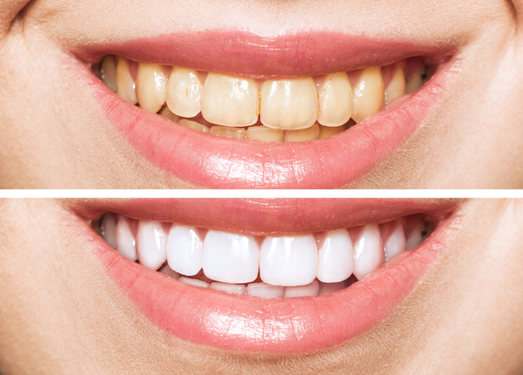住宅リフォーム7