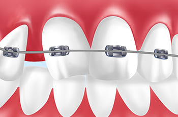 ortho-img22