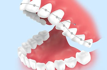 ortho-img23
